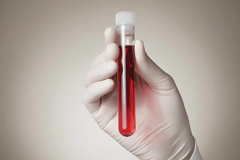 Multiple Sclerosis research in vitro-to-patient toolbox