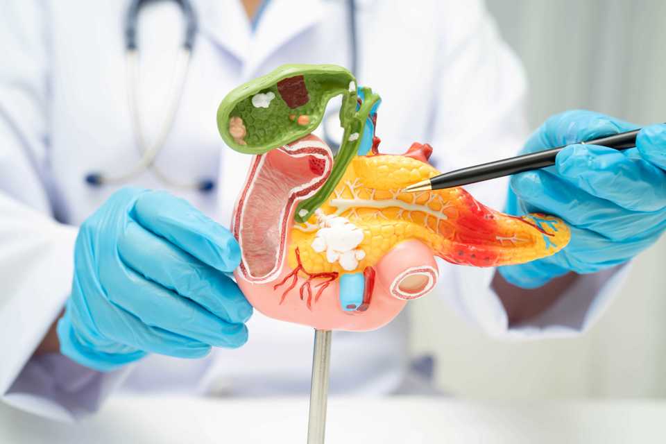 Pancreasfonds