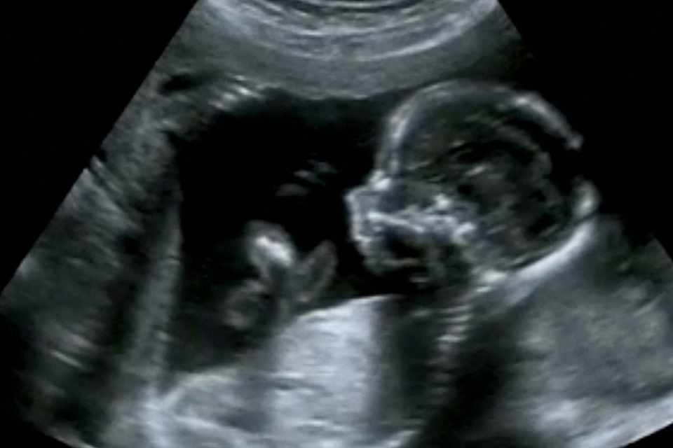 Foetus Onderzoek Roetdeeltjes Tim Nawrot