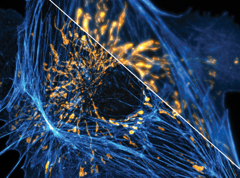 Advanced Microscopy