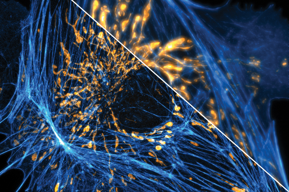 Advanced Microscopy