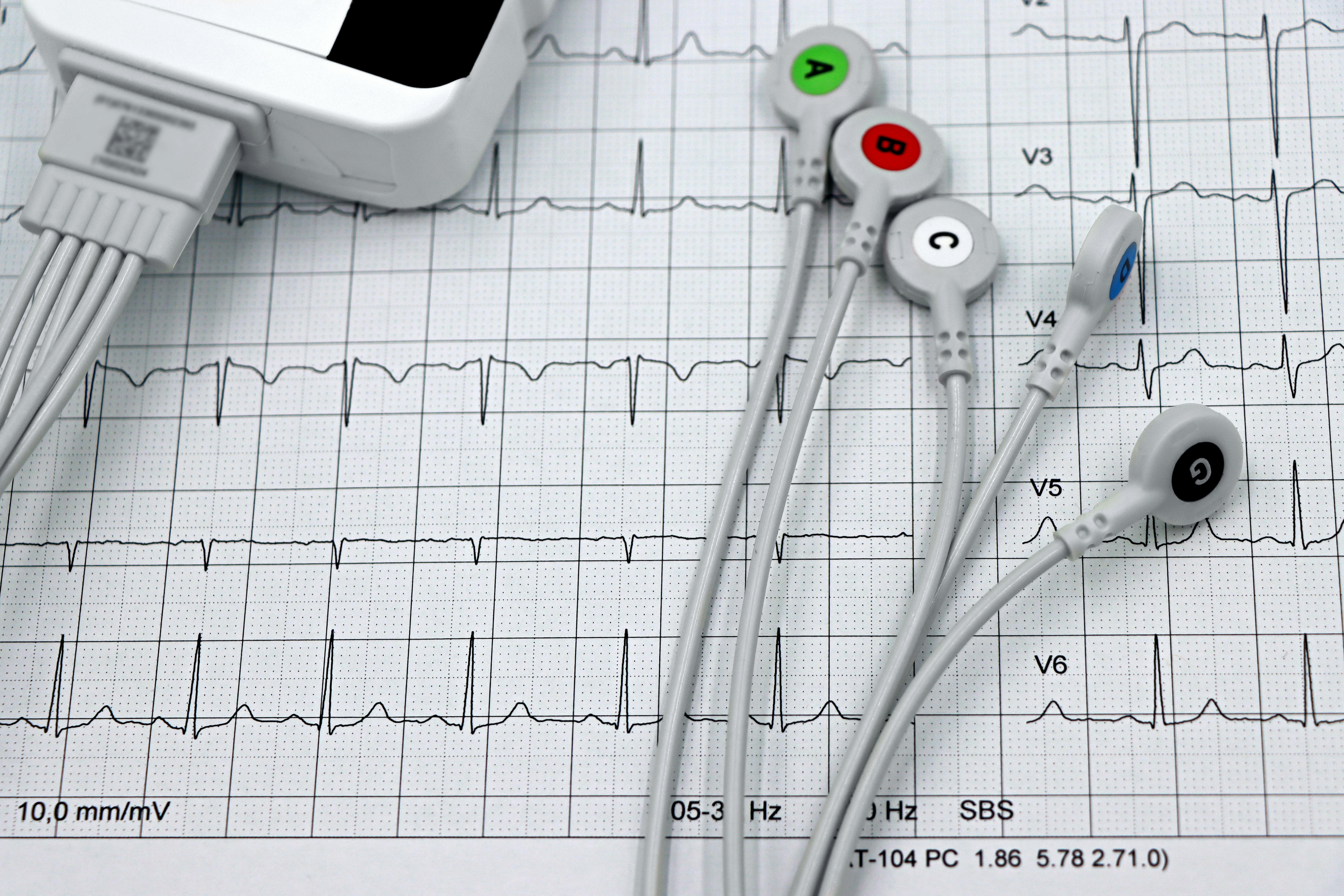 ECG Opleiding