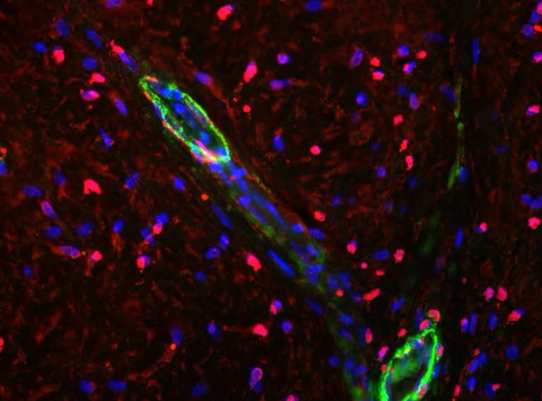 Angiogenesis
