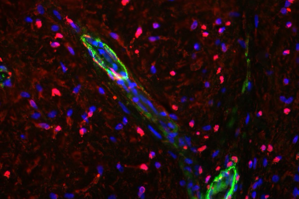 Angiogenesis