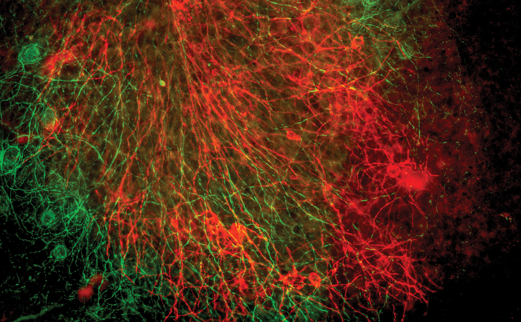 MS in vitro model