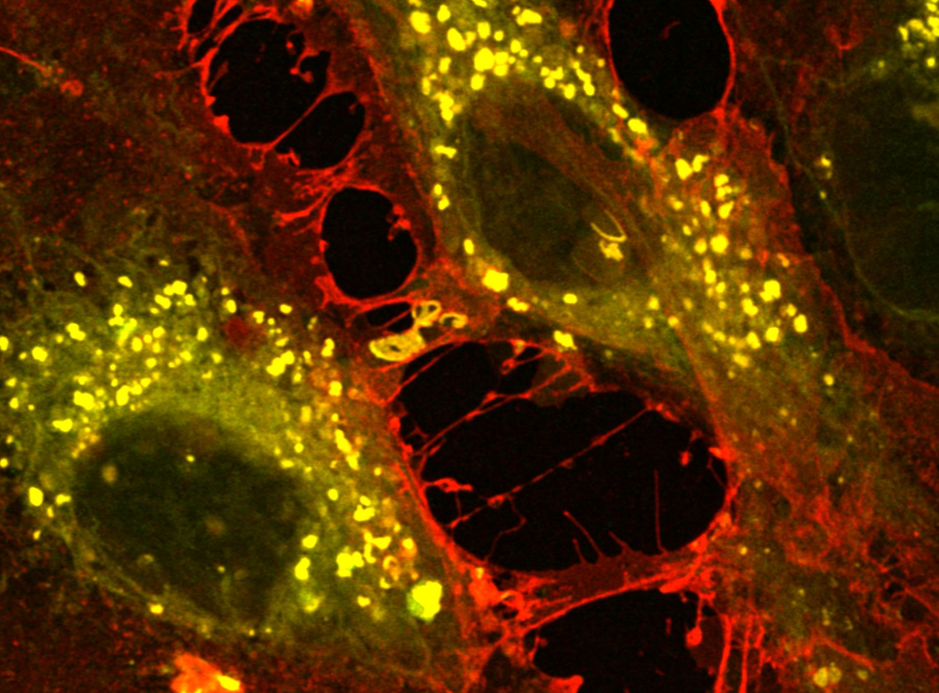 Advanced Microscopy