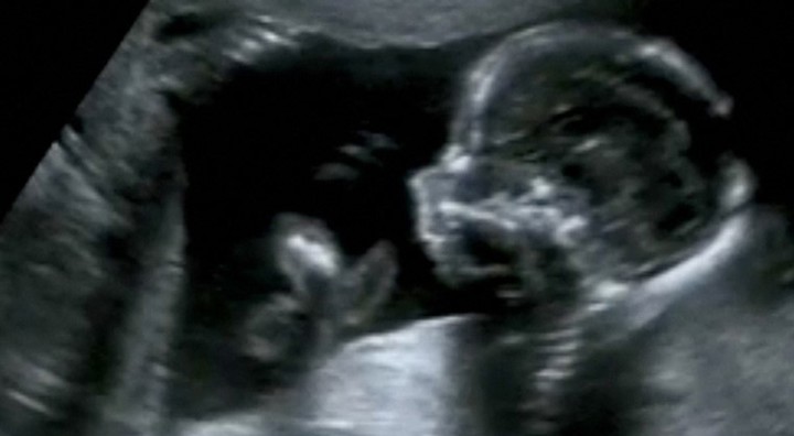 Foetus Onderzoek Roetdeeltjes Tim Nawrot